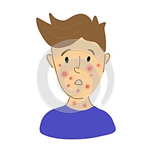Male suffering from new virus Monkeypox. kid face sick with chickenpox pox virus infection. flat character portrait. Red photo