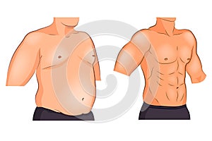 Male torso before and after weight loss and sports