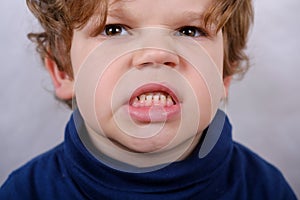 Malocclusion of the boy