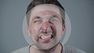 Malocclusion in young Caucasian male, crowded upper teeth. Ugly teeth with terrible smile. Close-up portrait of man with