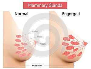 Mammary gland, Non-Lactating and Engorged breast, Female breast Anatomy, Vector