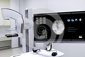 A mammogram machine showing breast cancer image on a computer monitor