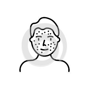 Man acne on face icon