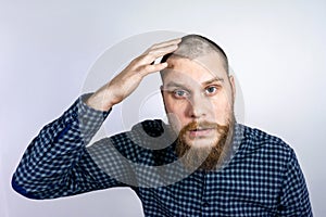 Man with alopecia on head, touching hair. Spot Baldness, Hair fall problem