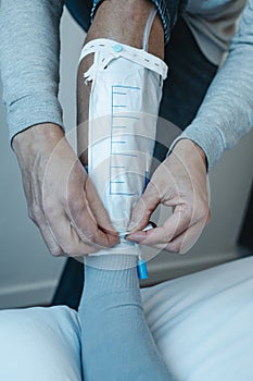 man attaching a urine drainage bag to his leg