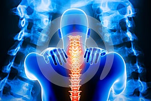 Man back body with spine and x-ray vertebrae imagery in the background. Neck pain or cervicalgia, backbone or cervical injury 3d photo