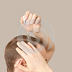 Man baldness treatment. Nature hair care