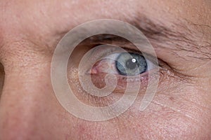 Man with blue eyes and a corrective contact lens.