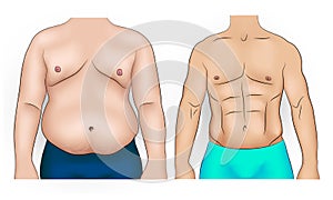 Man body before and after weight loss