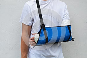 Man with broken arm wrapped medical cast plaster and blue bandage. Fiberglass cast covering the wrist, arm, elbow after sport