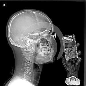 Man and cellphone under x-ray