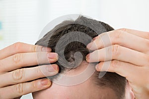 Man Checking Hairline At Home photo