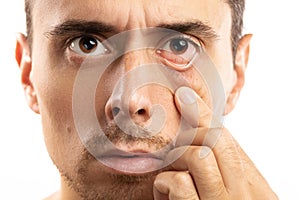 Man checking health condition of his eye