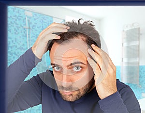 Man controls hair loss