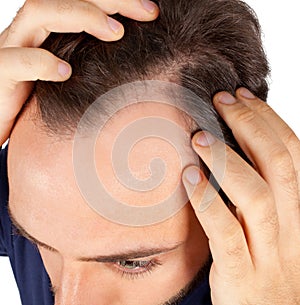 Muž řízení vlasy ztráta 