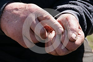 Man counting with his fingers