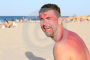 Man crying after a long sun exposure