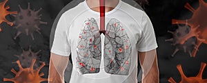 Man with diseased lungs surrounded by viruses on background