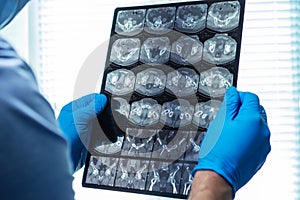 Man doctor in mask examines head MRI in hospital