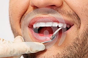 Man doing teeth checkup