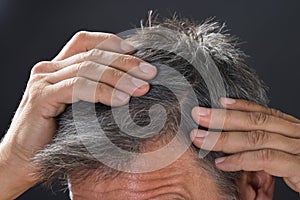 Man Examining His White Hair photo