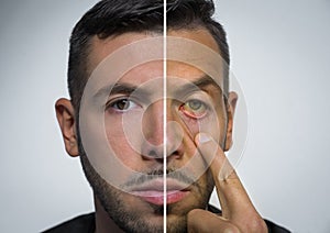 Man face divided into two parts one healthy and one unhealthy. Alcohol harm.