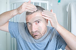 Man is feeling worried about hair loss