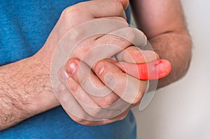 Man with finger pain is holding his aching finger