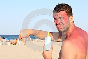 Man getting sunburned at the beach