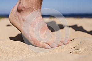 Man goes on the beach and the risk of stepping on a splinter of broken bottle glass