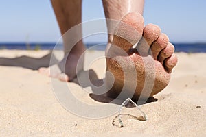 Man goes on the beach and the risk of stepping on a splinter of broken bottle glass