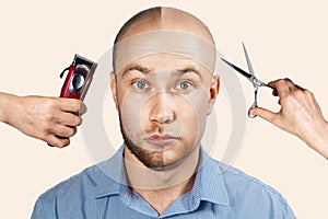 Man before and after hair loss, alopecia on background with hands that derat shaving machine and scissors