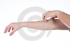 Man hand scratching his hand  white background. Medical, healthcare for advertising concept photo