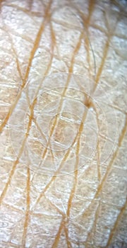 Man hand skin view at the microscope texture