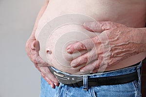 Man has hands on his pot belly