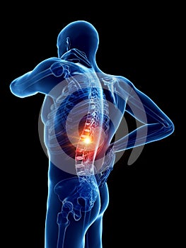 a man having a painful back