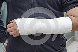 Man with his broken arm. Arm in cast.