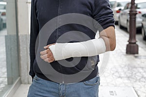 Man with his broken arm. Arm in cast. photo