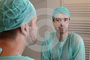 Man with his face all marked and ready for plastic surgery
