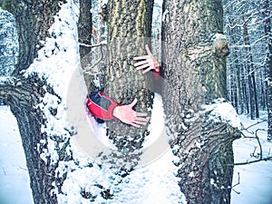 Man hold tree trunk with the frozen bark covered with sticky snow