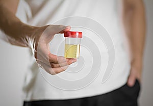 A man holds a jar with a urine test. Close up photo