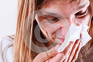 Man with hygienic tissue