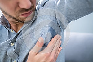 Man With Hyperhidrosis Sweating Very Badly photo