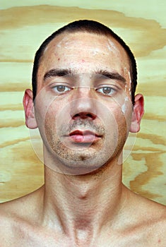 Man with infected skin on the face