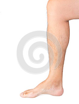 Man leg