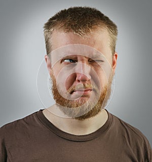 Man looking off to the side with one eye
