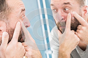 Man looking at pimples on his face