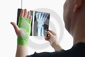 A man looks at an x-ray and a hand in a bandage