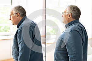 Man With Lordosis And Normal Curvature photo