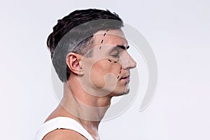 Man marked with lines for plastic surgery